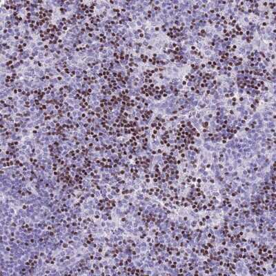 Immunohistochemistry-Paraffin: BCL11B Antibody [NBP2-33549]