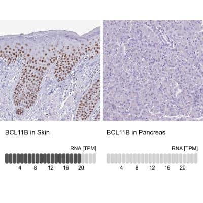 Immunohistochemistry-Paraffin: BCL11B Antibody [NBP2-33549]