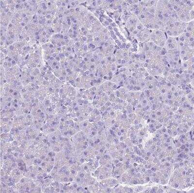 Immunohistochemistry-Paraffin: BCL11B Antibody [NBP2-33549]