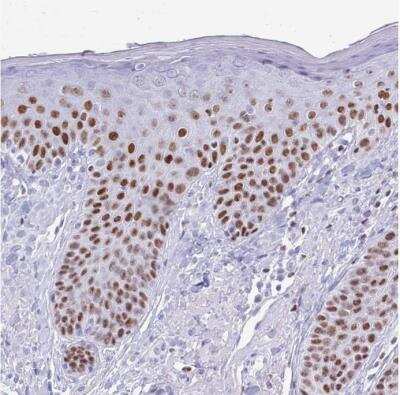 Immunohistochemistry-Paraffin: BCL11B Antibody [NBP2-33549]