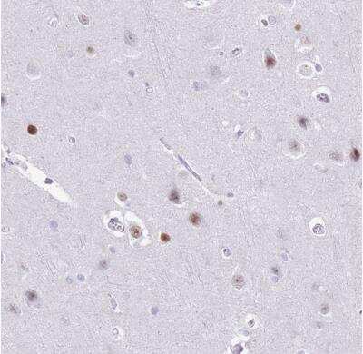 Immunohistochemistry-Paraffin: BCL11B Antibody [NBP2-33549]
