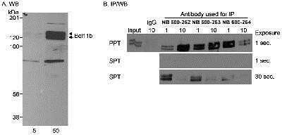 Immunoprecipitation: BCL11B Antibody [NB600-262]