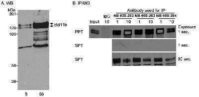 Immunoprecipitation: BCL11B Antibody [NB600-263]
