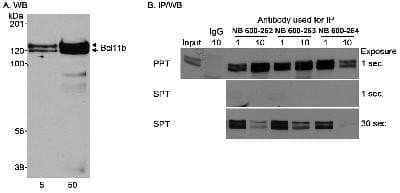 Immunoprecipitation: BCL11B Antibody [NB600-264]