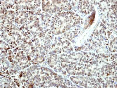 Immunohistochemistry-Paraffin: BCL2L10 Antibody [NBP2-15557]