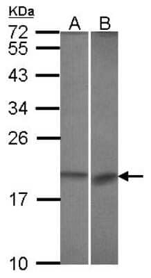 Western Blot: BCL2L10 Antibody [NBP2-15557]