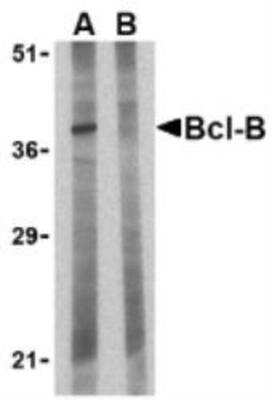 Western Blot: BCL2L10 Antibody Blocking Peptide [NBP1-77224PEP]