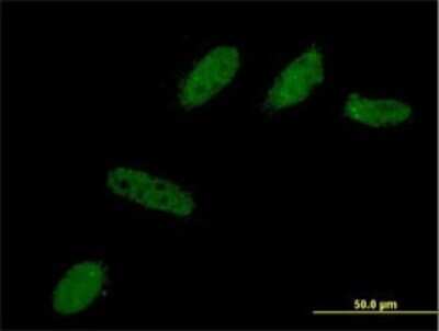 Immunocytochemistry/ Immunofluorescence: BCL2L12 Antibody (1B1) [H00083596-M01]