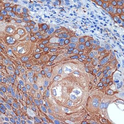 Immunohistochemistry-Paraffin: BCL2L12 Antibody (4Z2Z8) [NBP3-15930]