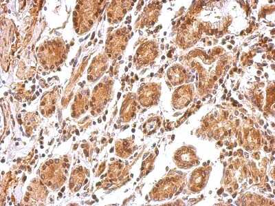Immunohistochemistry-Paraffin: BCL2L12 Antibody [NBP1-31701]