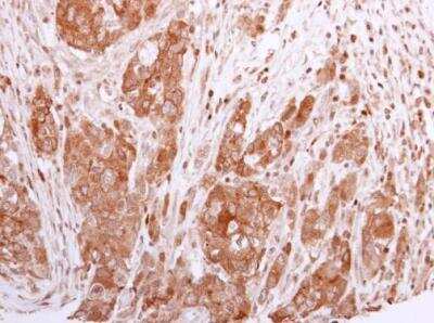 Immunohistochemistry-Paraffin: BCL2L12 Antibody [NBP1-31701]