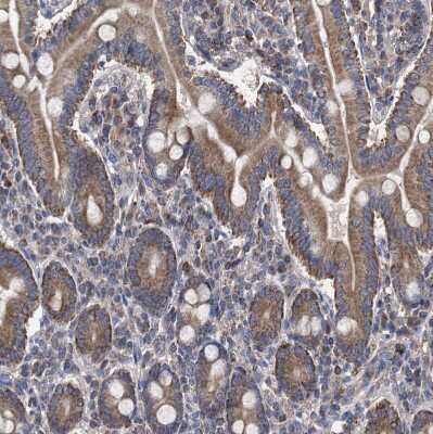 Immunohistochemistry-Paraffin: BCL2L12 Antibody [NBP1-86025]