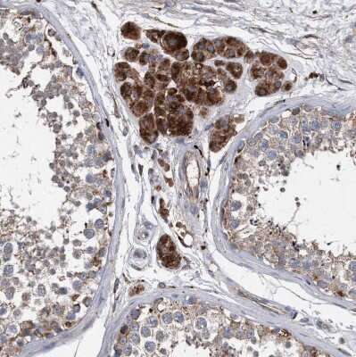 Immunohistochemistry-Paraffin: BCL2L12 Antibody [NBP1-86025]