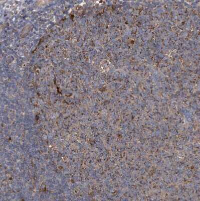 Immunohistochemistry-Paraffin: BCL2L12 Antibody [NBP1-86025]