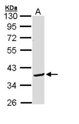 Western Blot: BCL2L12 Antibody [NBP1-31701]