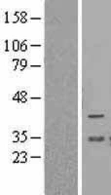 Western Blot: BCL2L12 Overexpression Lysate [NBL1-07947]