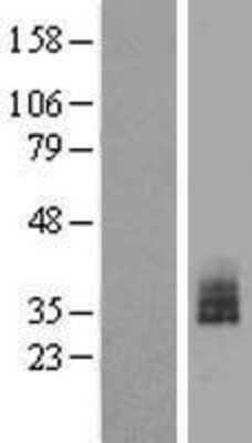 Western Blot: BCL2L12 Overexpression Lysate [NBP2-08340]