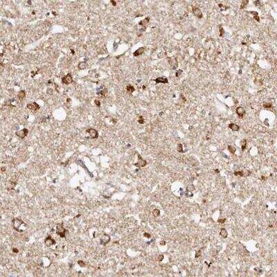 Immunohistochemistry: BCL2L15 Antibody [NBP1-90768]