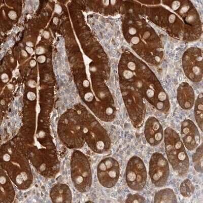 Immunohistochemistry-Paraffin: BCL2L15 Antibody [NBP1-90767]