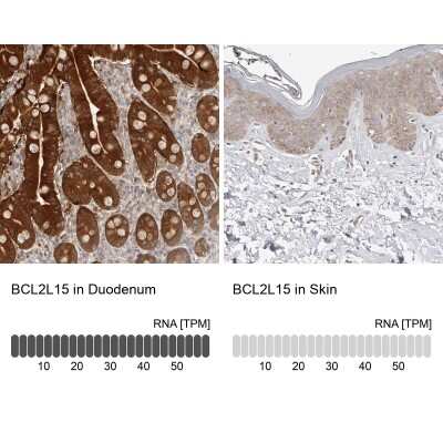 Immunohistochemistry-Paraffin: BCL2L15 Antibody [NBP1-90767]