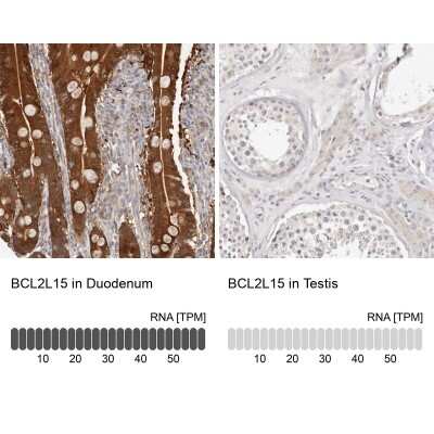 Immunohistochemistry-Paraffin: BCL2L15 Antibody [NBP1-90767]