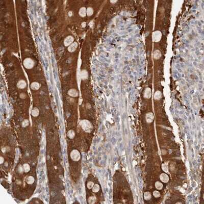 Immunohistochemistry-Paraffin: BCL2L15 Antibody [NBP1-90767]