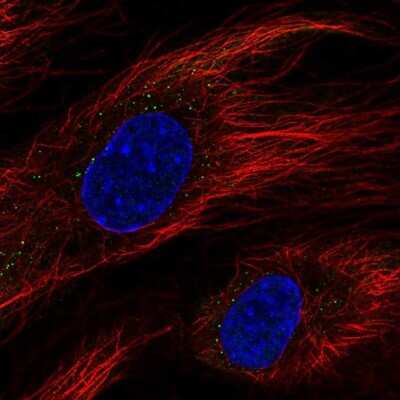 Immunocytochemistry/ Immunofluorescence: BCL6B Antibody [NBP2-68997]