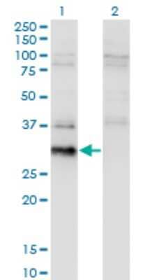 Western Blot: BCL7B Antibody (4G1) [H00009275-M02]