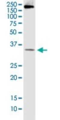 Western Blot: BCL7B Antibody (6D2) [H00009275-M01]