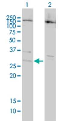 Western Blot: BCL7B Antibody (6D2) [H00009275-M01]