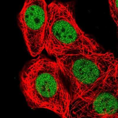 Immunocytochemistry/ Immunofluorescence: BCL7B Antibody [NBP2-55835]