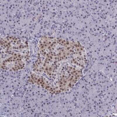 Immunohistochemistry-Paraffin: BCL7B Antibody [NBP2-34097]