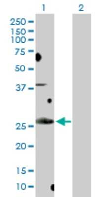 Western Blot: BCL7B Antibody [H00009275-D01P]