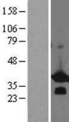 Western Blot: BCL7B Overexpression Lysate [NBL1-07954]