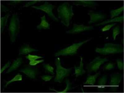 Immunocytochemistry/ Immunofluorescence: BCL7C Antibody (1A4) [H00009274-M02]