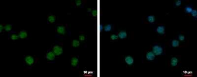 Immunocytochemistry/ Immunofluorescence: BCL7C Antibody [NBP2-15559]