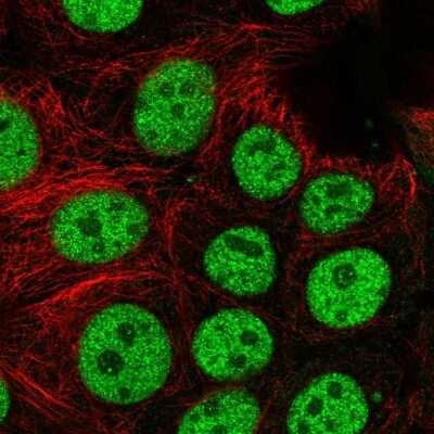 Immunocytochemistry/ Immunofluorescence: BCL7C Antibody [NBP2-55715]