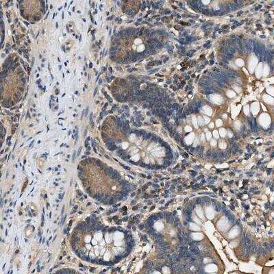 Immunohistochemistry: BCL7C Antibody [NBP1-86441]