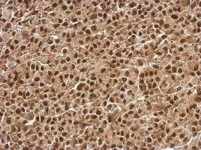 Immunohistochemistry-Paraffin: BCL7C Antibody [NBP2-15559]