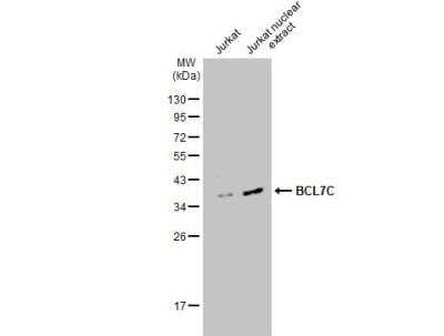 Western Blot: BCL7C Antibody [NBP2-15559]