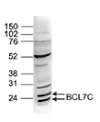 Western Blot: BCL7C Antibody [NBP3-18642]