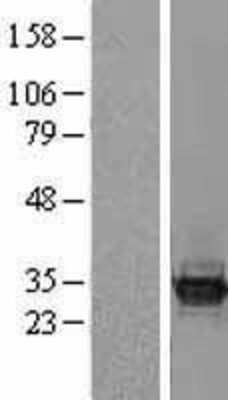 Western Blot: BCL7C Overexpression Lysate [NBL1-07955]