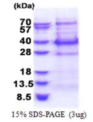 SDS-PAGE: Recombinant Human BCL7C His Protein [NBP2-22708]