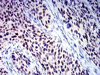 Immunohistochemistry: BCL9-2 Antibody (3B9C1) - BSA Free [NBP2-61823]