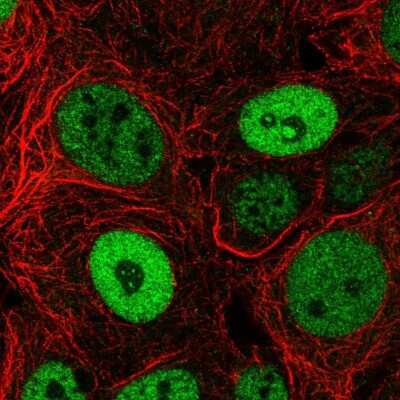 Immunocytochemistry/ Immunofluorescence: BCL9-2 Antibody [NBP2-55060]