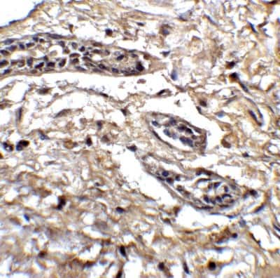 Immunohistochemistry: BCL9-2 Antibody - BSA Free [NBP1-76542]