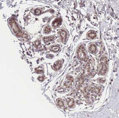 Immunohistochemistry-Paraffin: BCL9-2 Antibody [NBP2-14350]