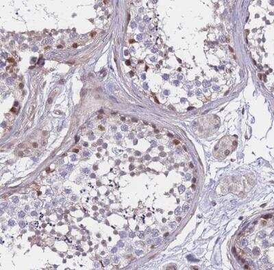 Immunohistochemistry-Paraffin: BCL9-2 Antibody [NBP2-14350]