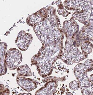 Immunohistochemistry-Paraffin: BCL9-2 Antibody [NBP2-14350]