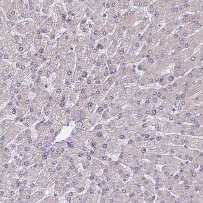 Immunohistochemistry-Paraffin: BCL9-2 Antibody [NBP2-14350]